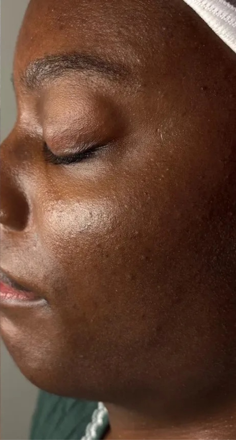 Reyna Esthetics After 5