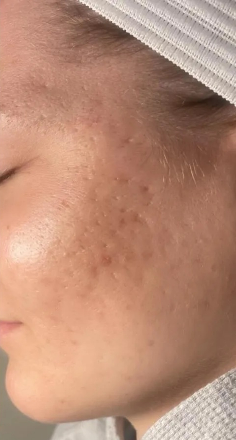 Reyna Esthetics After 6