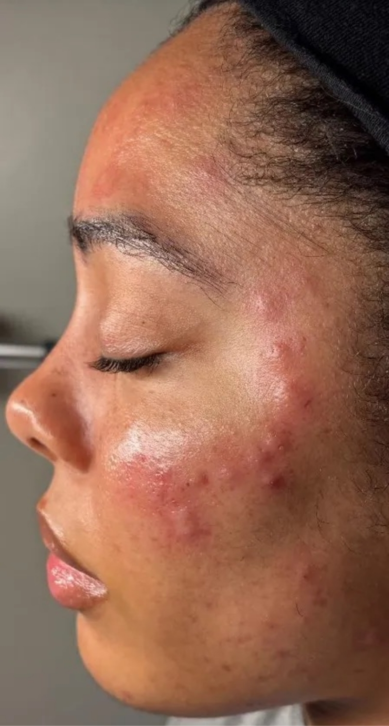 Reyna Esthetics Before 2