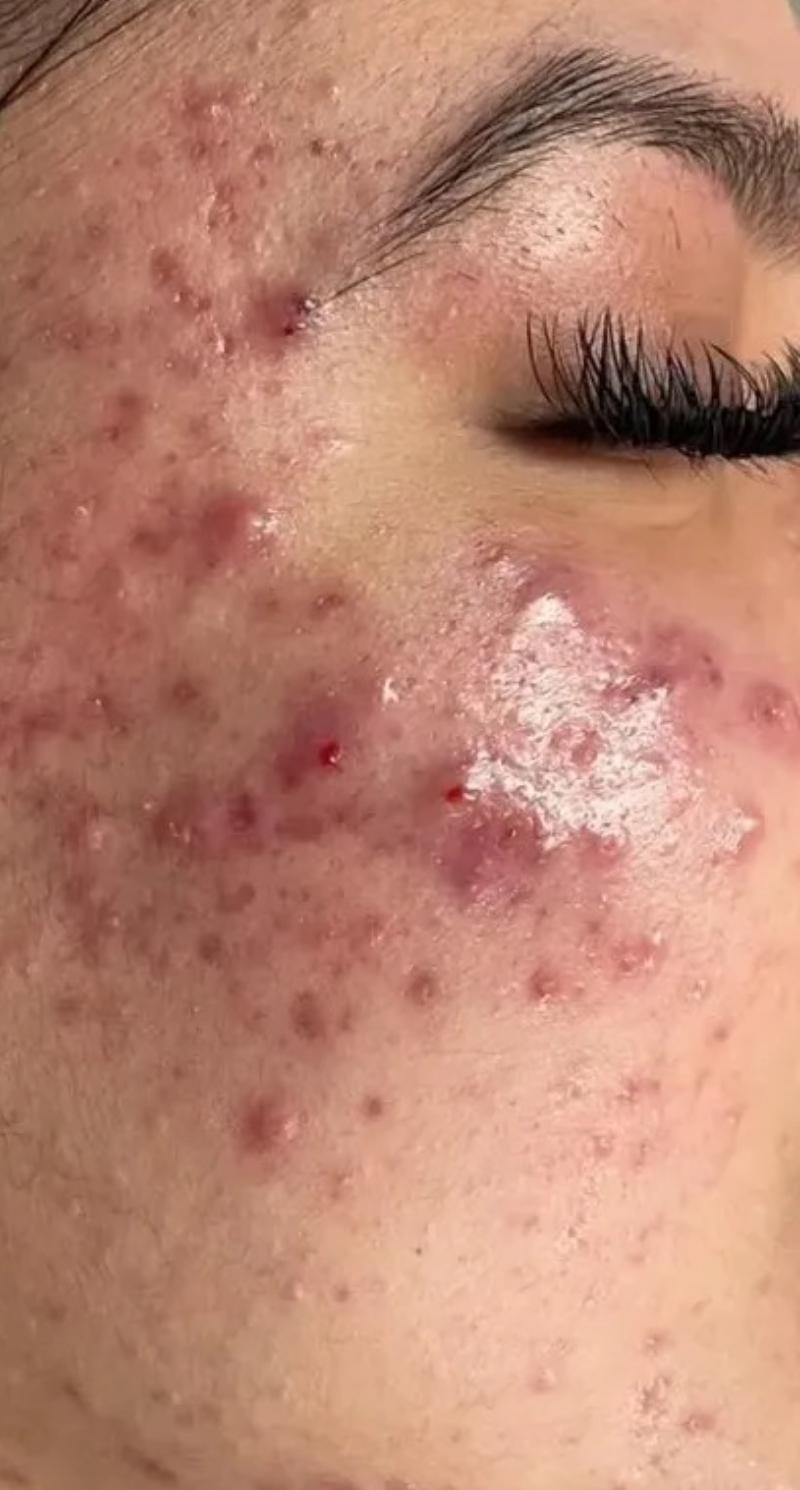 Reyna Esthetics Before 3