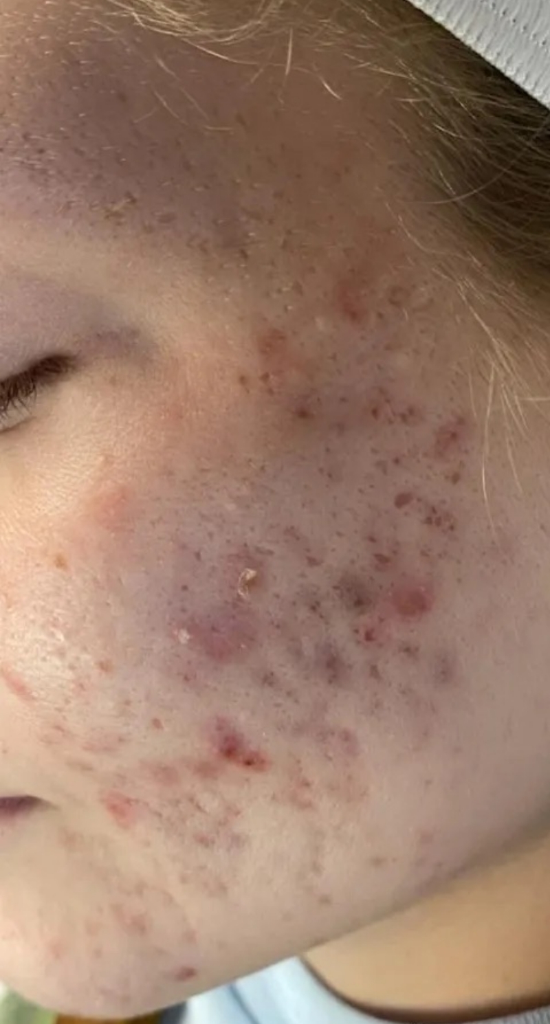 Reyna Esthetics Before 6